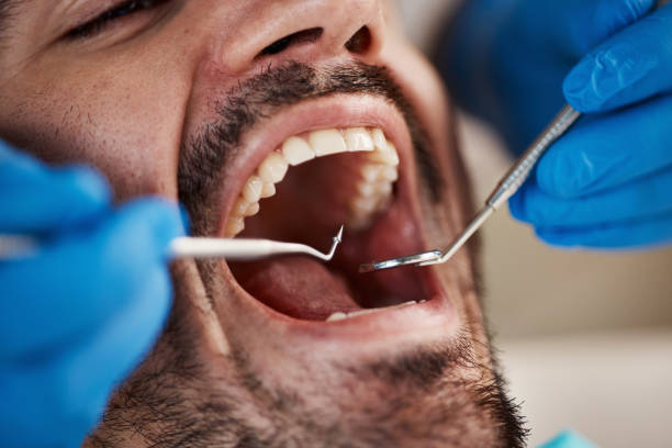 Dental Bonding in Branford Center, CT
